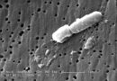 Бактерии Klebsiella pneumoniae под електронен микроскоп