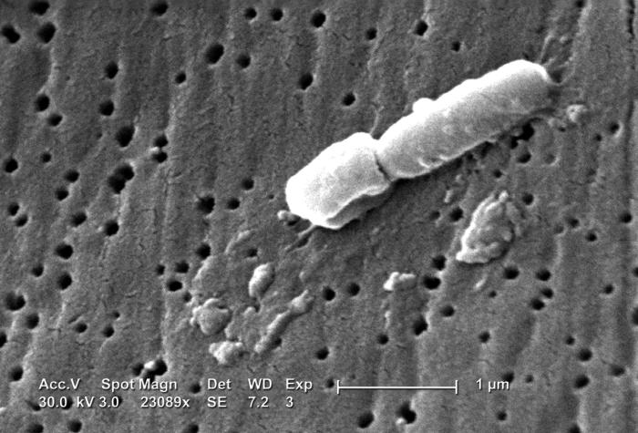 Бактерии Klebsiella pneumoniae под електронен микроскоп
