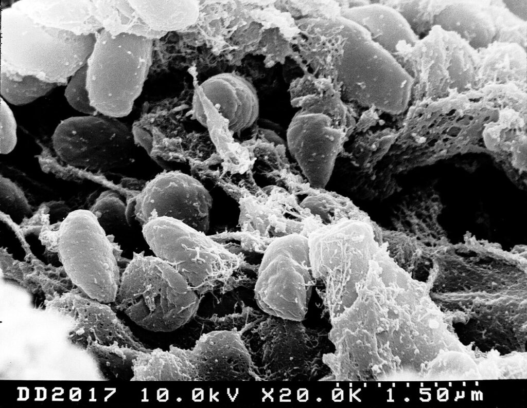 Бактерии Yersinia pestis, причинител на чумата, под сканиращ електронен микроскоп