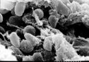 Бактерии Yersinia pestis, причинител на чумата, под сканиращ електронен микроскоп