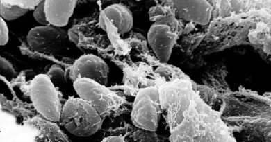 Бактерии Yersinia pestis, причинител на чумата, под сканиращ електронен микроскоп