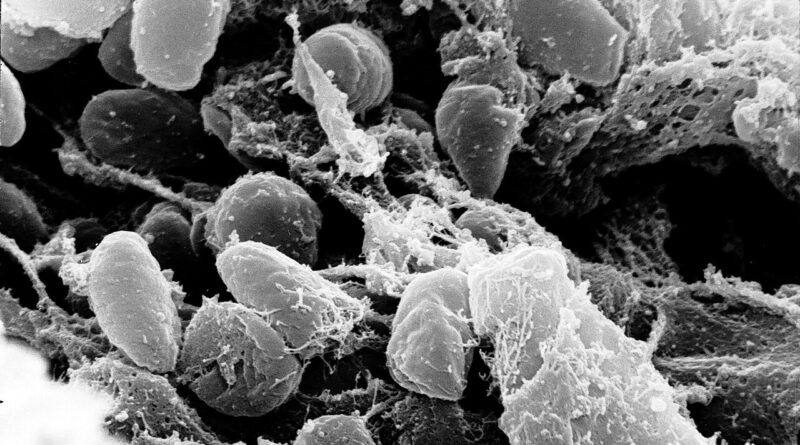 Бактерии Yersinia pestis, причинител на чумата, под сканиращ електронен микроскоп